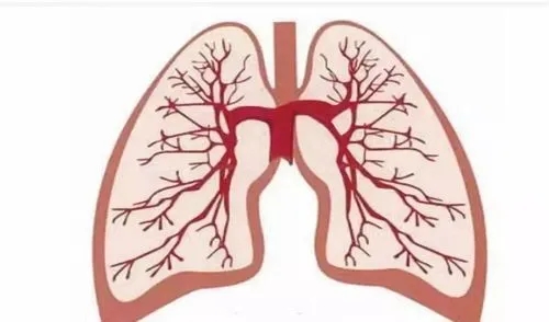 老人肺部感染最怕三个征兆，意识模糊/乏力食欲不振/呼吸困难