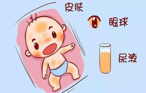 黄疸高对婴儿有什么影响，严重时会让宝宝发育滞后