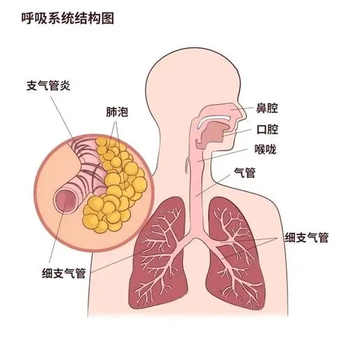 支气管炎偏方三天见效除根太神了，香油蜂蜜冲鸡蛋/生姜萝卜汁等