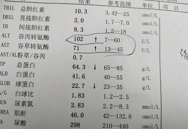 一般转氨酶多少就是肝炎了，一般是0-40IU/L以上
