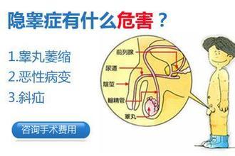 睾丸隐睾手术多少钱,儿童隐睾手术多少钱