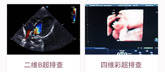 二维彩超多少钱