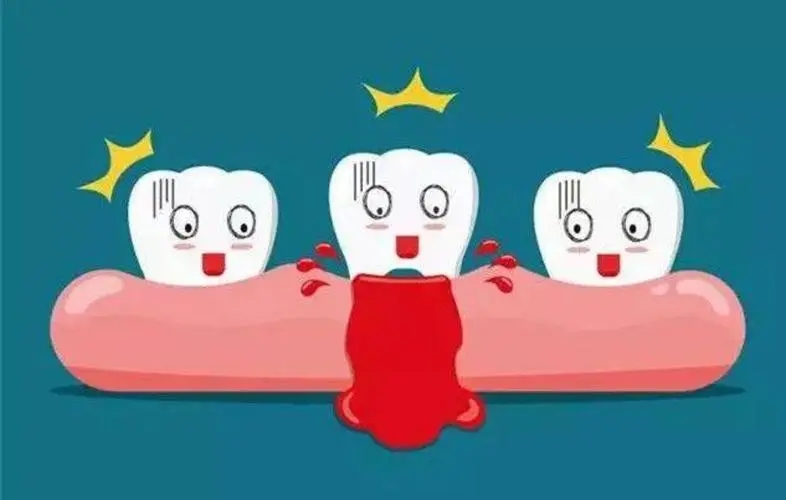 牙龈出血要警惕三种病，牙龈炎/白血病/糖尿病(牙龈出血频率高